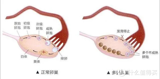 没错,月经正常的女性,每个月卵巢都会发育出一些小卵泡,最后排出一个