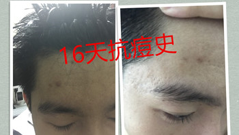 抗痘人士18天使用报告，看看你是否也需要来一份Proactiv