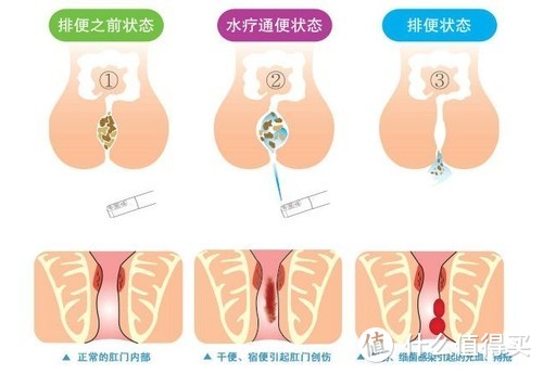 自从有了它,“菊花”乐哈哈：智米智能马桶你想知道的都在这