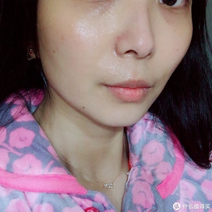 点痣后的近况