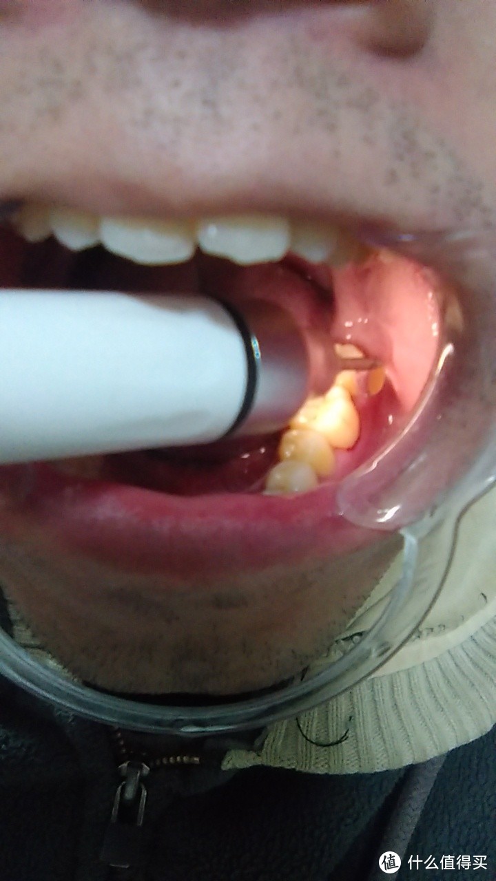 洗牙自己来：共2700元的超声波洁牙机，旋转/声波/牙套电动牙刷、冲牙器缺陷合集