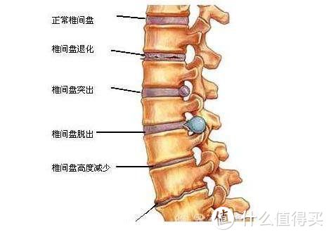 #全民运动季#剁主计划-长沙#腰痛？腰酸？怎么备战全民健身季？----从腰椎康复训练说起