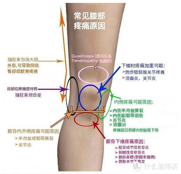 图2-53 不同部位的跑步膝原因一览图