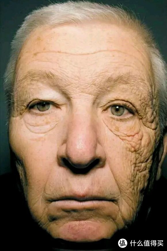 著名的卡车司机照片，她的左侧脸就是因为长期开车过程受太阳照射导致的衰老和损坏，眼球晶体也有损伤。