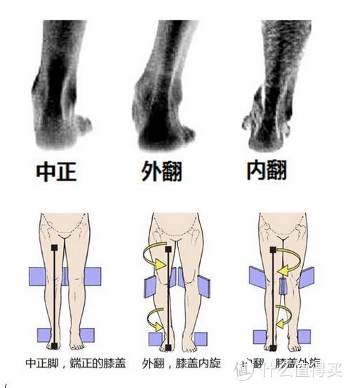 我需要准备哪些跑步装备