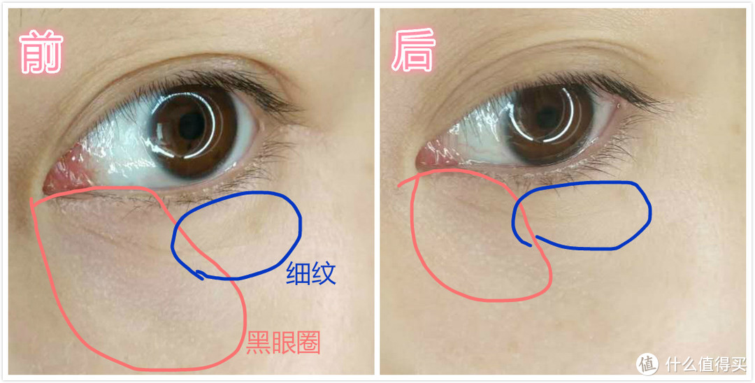 Dr Dennis Gross抗老/祛黑眼圈眼霜使用感受分享（附对比图）