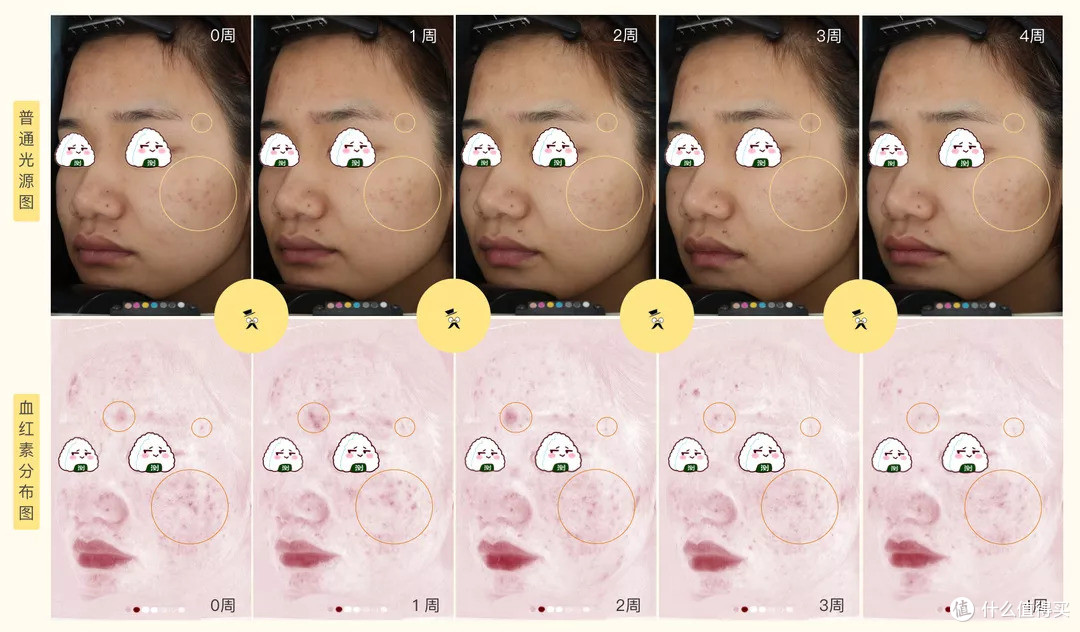 陈年老痘印怎么去除 | 痘印痘坑如何修复_什么值得买