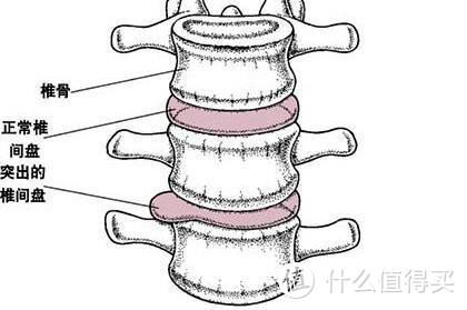 《真健》篇八：跑完步竟腰疼？拿什么拯救你，我的腰