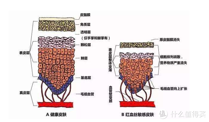 脸上出现了红血丝怎么办？消除红血丝，告别不自信