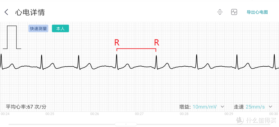 了解米动健康手环1S，关注心血管健康