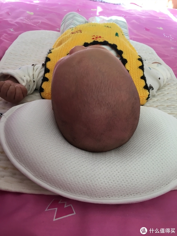 婴儿后脑勺枕骨沟图片图片