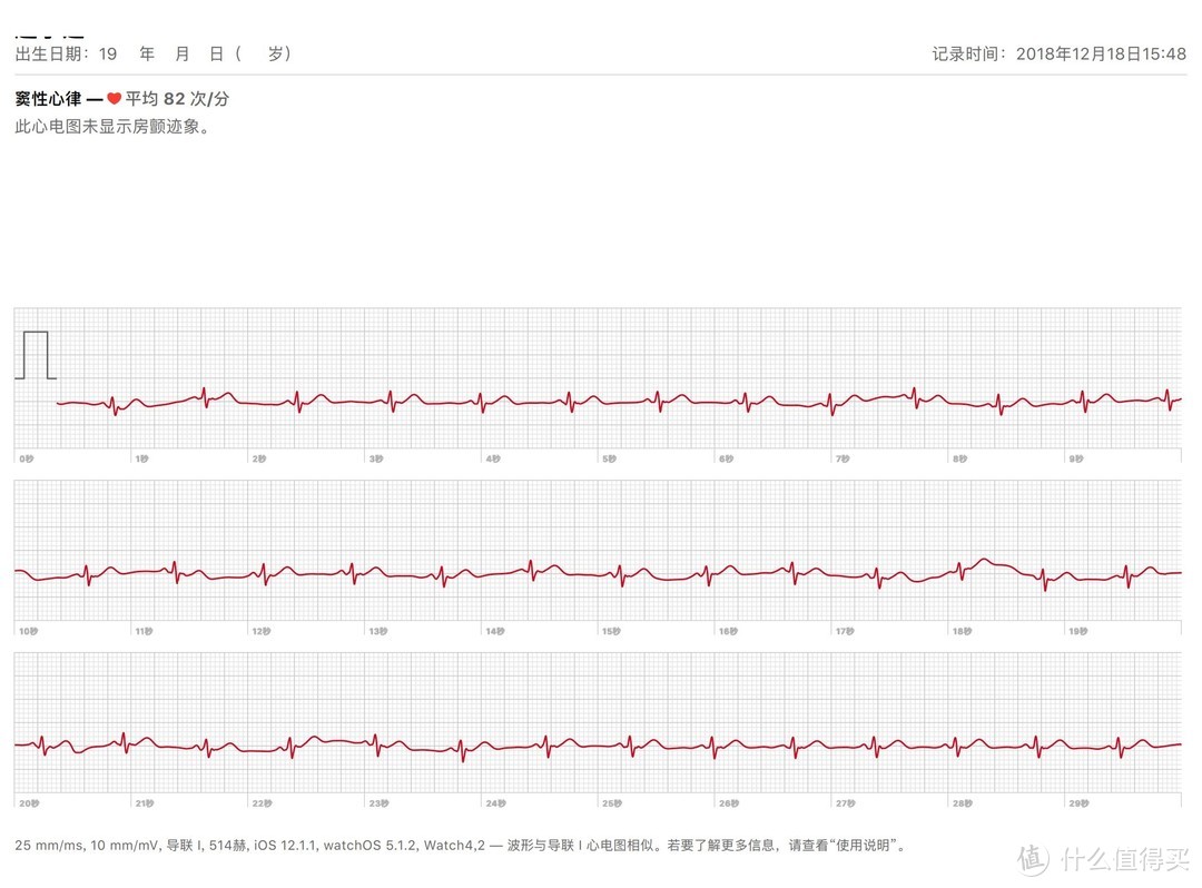 有了心电图，苹果手表S4才算完整