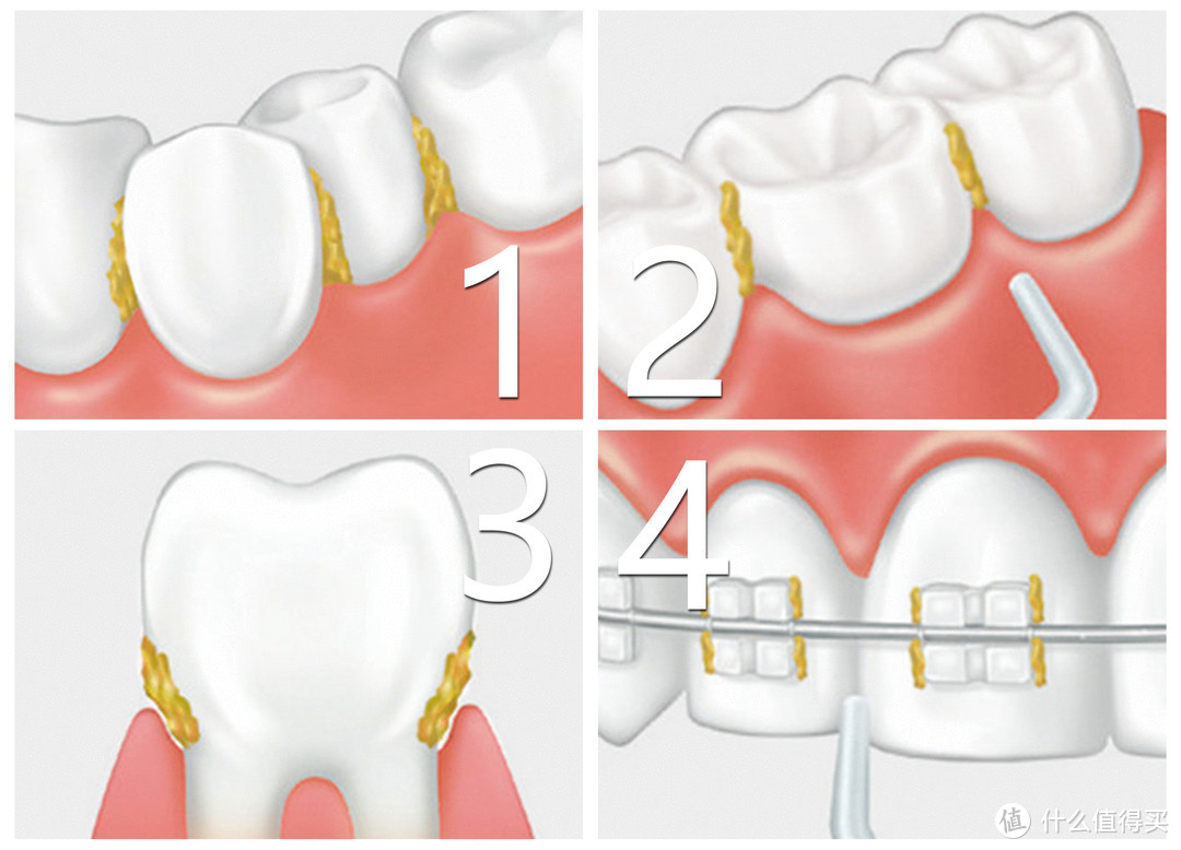 松下EWM1311水牙线（冲牙器）：随时随地给牙齿一次有氧SPA
