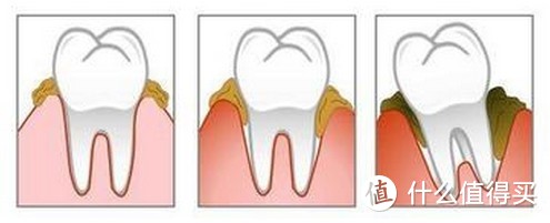 一款优秀的口腔清洁工具—零一冲牙器详细测评