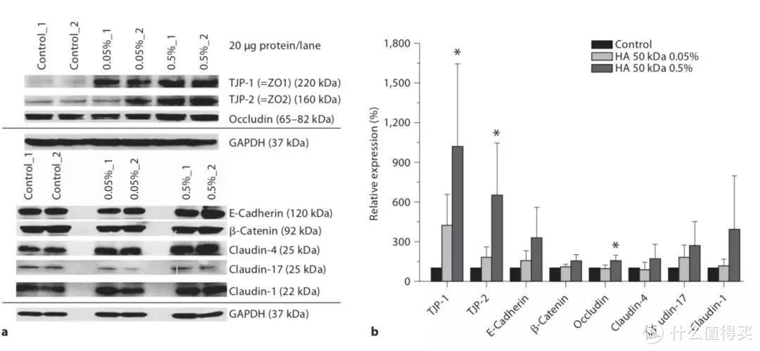 图片引自文献DOI: 10.1159/000324296