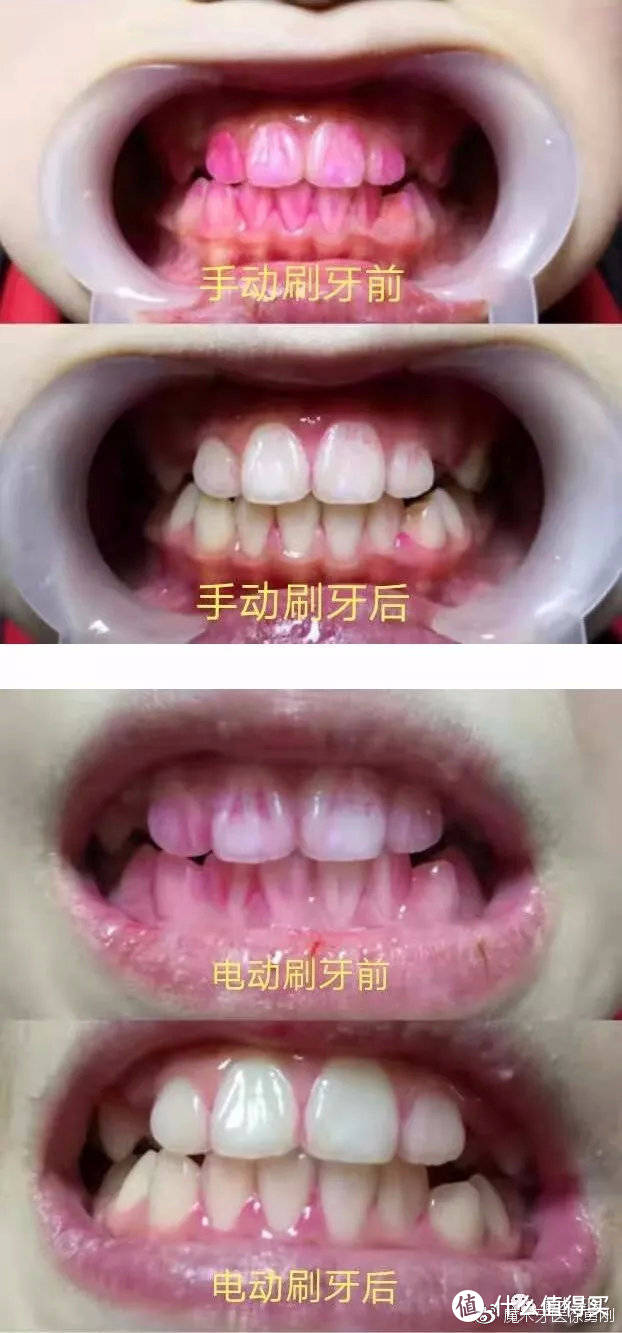 国货当自强，a teeth 萌牙家电动牙刷初体验！