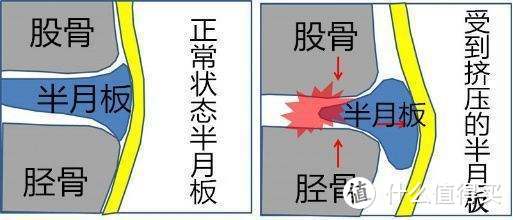 膝盖受伤只能静养？—3个健身冷思考