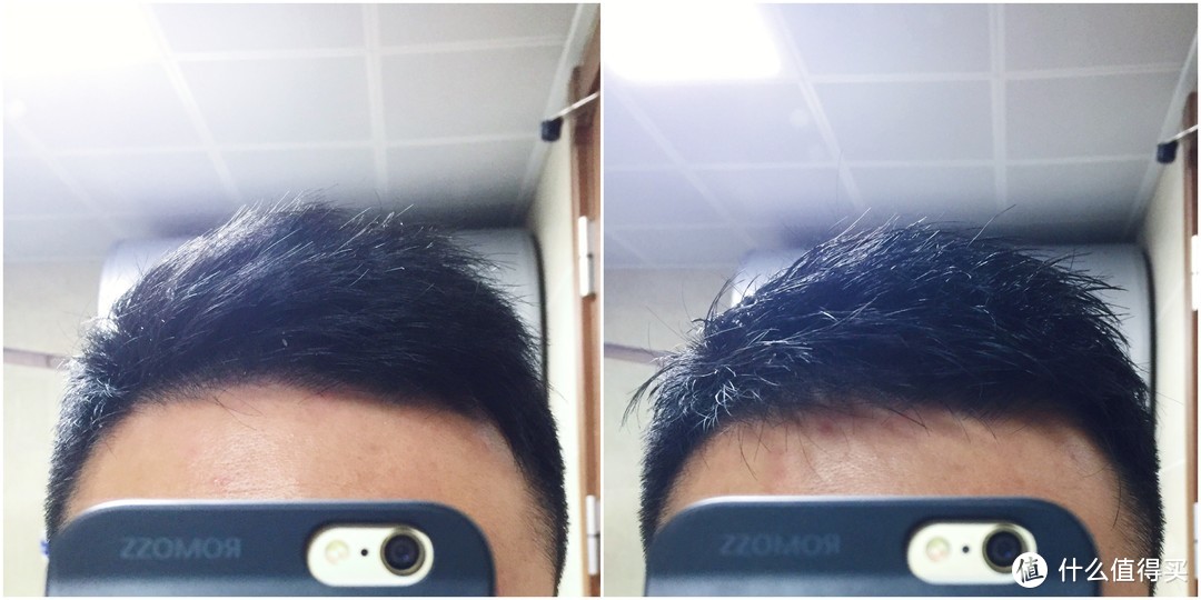 男士护发防脱大作战—我的头发养护四重奏