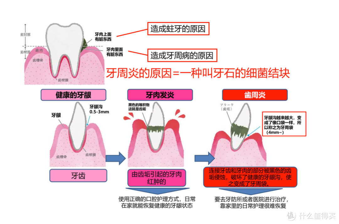 水牙线真的有用吗：松下 EW1511 便携冲牙器评测