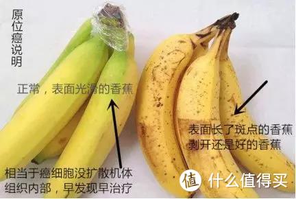 原位癌到底算不算癌症，保险赔不赔？