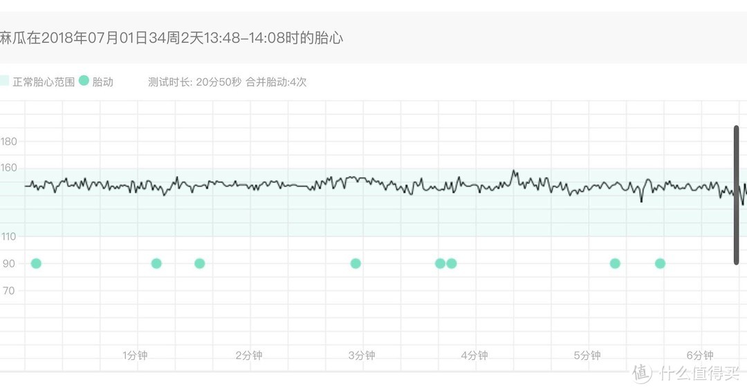 萌动的一次胎心监护截图，还是非常靠谱的，连医生都认可