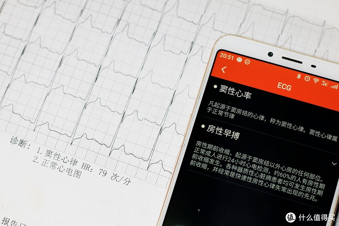 随时随地监测你的心脏健康，埃微i7E心电血压健康手环评测