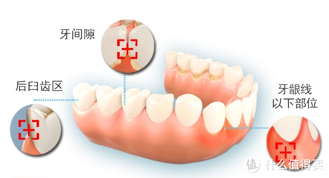 25岁小伙牙齿要拔光，竟与他做这件事有关！