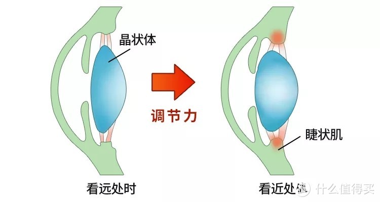 控制青少年近视度数增加该配什么样的镜片