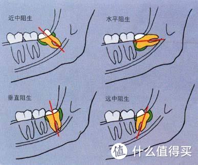 保姆级牙齿护理攻略！牙膏、智齿、科学刷牙、洗牙、牙齿美白这里全都有~