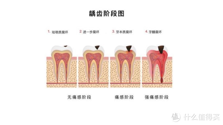 孩子不爱刷牙？试试这款酸奶味的牙膏