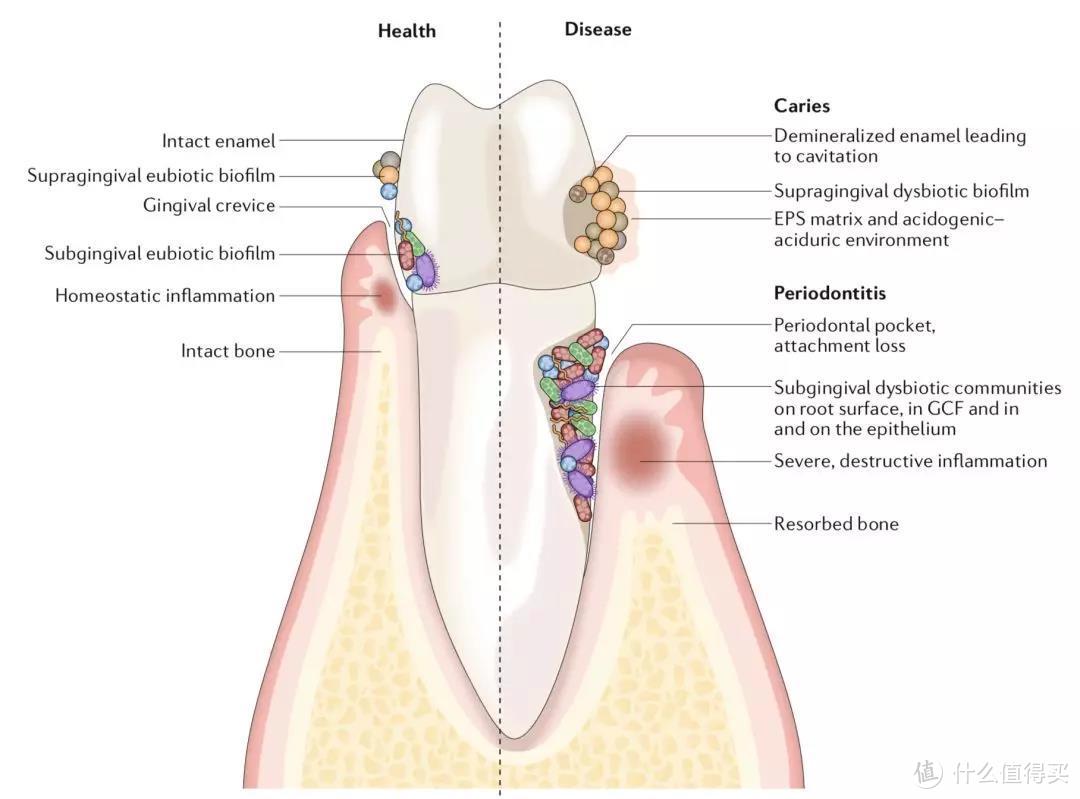 牙齿表面菌群差异，左半部分为健康牙齿，右半部分为有疾病的牙齿