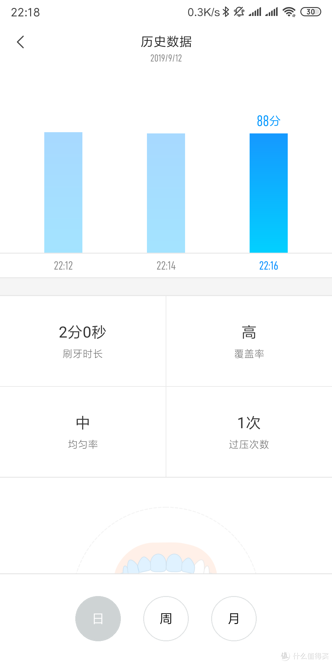 电动牙刷牙医的推荐——米家T500电动牙刷使用评测