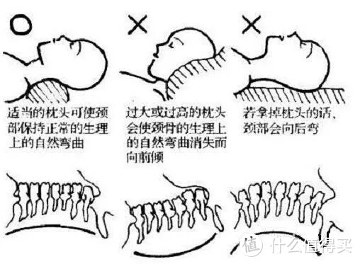 我唯一想要的，就是一只一发入魂的香枕：一个资深颈椎病患的自我救赎之道