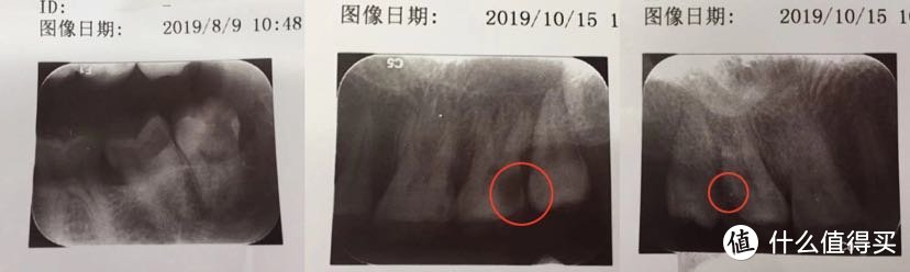 我去（囧）北大口腔拔了好多牙（就医指南）挂号拔牙洗牙篇