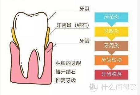 刷牙的正确打开方式，关于牙刷和牙膏的选择及牙齿小问题！