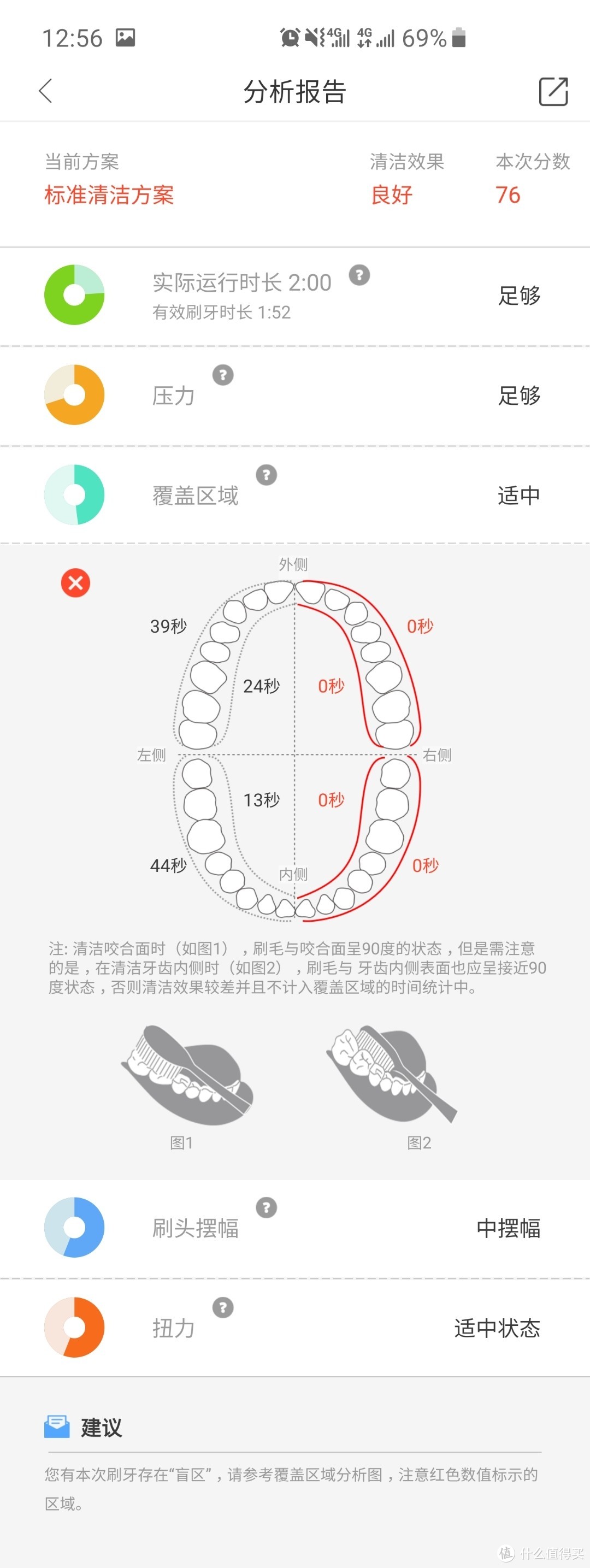 欧可林z1电动牙刷简单体验