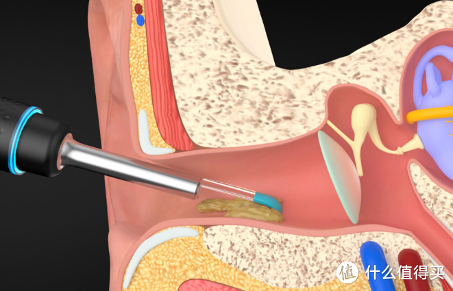 掏耳一时爽，一直掏一直爽：小米有品开卖智能可视采耳棒，144种采耳爽瘾