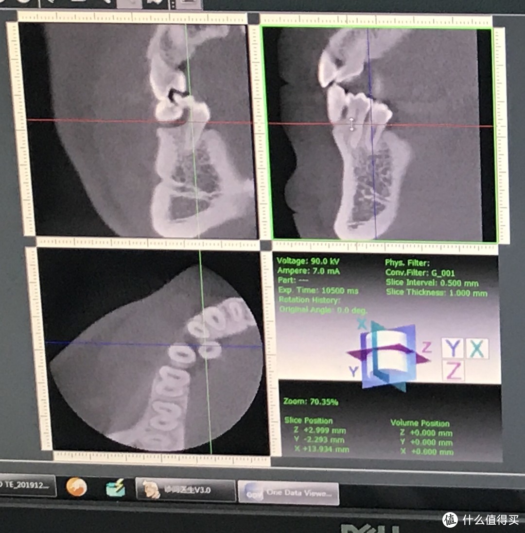 几经周折后拔掉的多齿生齿，还能用来做测评？