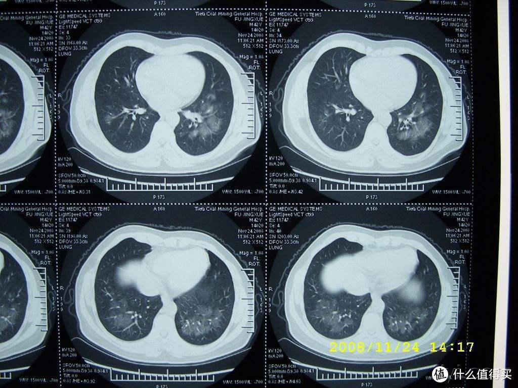 【减肥与健康 篇一】从8电极体脂秤来谈谈人体成分测量方法