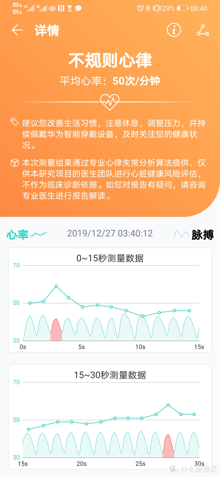 防猝死还是更焦虑？专业解读华为心律筛查301医院心脏健康研究 Watch GT2心律不齐早搏房颤