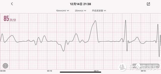 手腕上的健康管家，医疗级心电健康手表，乐心心电手表H1