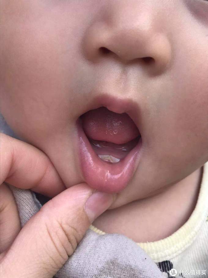 一岁娃的第一次九院牙医初体验~~附挂号攻略