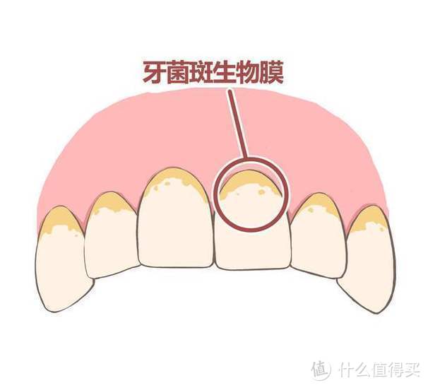 无数次的护牙之旅，“直白”地做自己