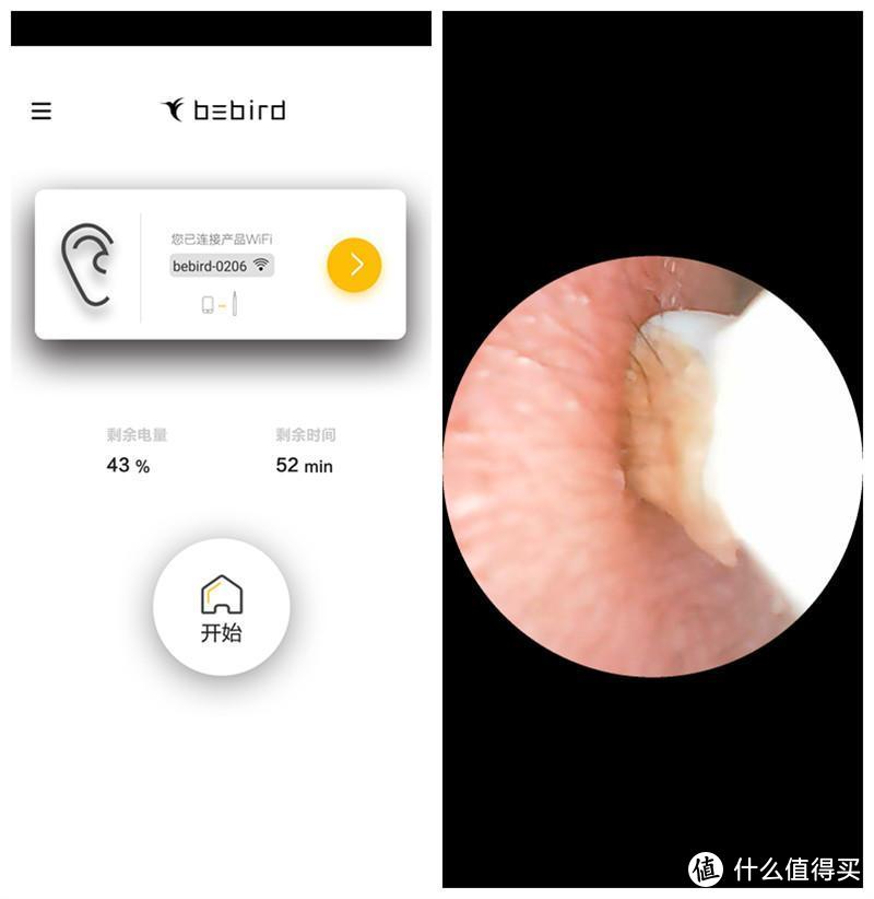 蜂鸟智能可视采耳棒M9 Pro：治愈系采耳，让你喜欢上掏耳朵
