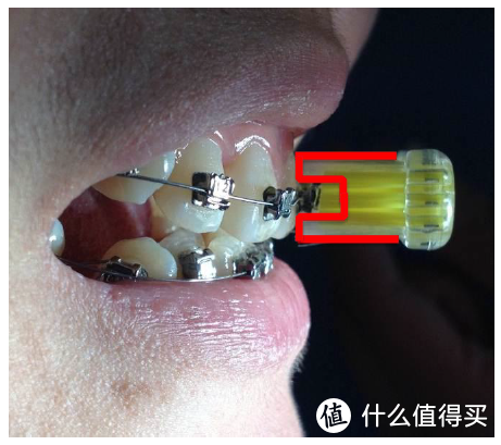 正畸U形牙刷