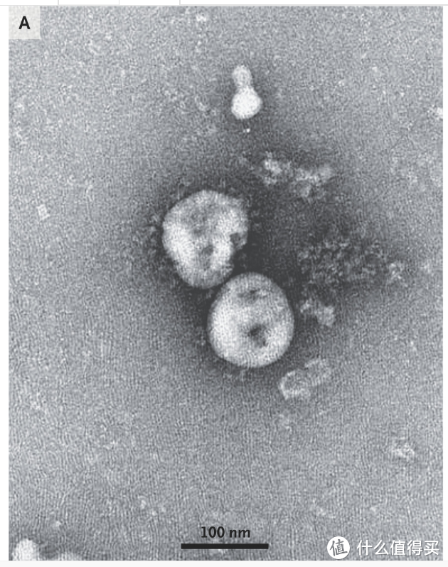 武汉新型冠状病毒在透射电子显微镜下的照片