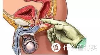  每年体检该选什么项目？早期癌症检查项目你都知道了么？