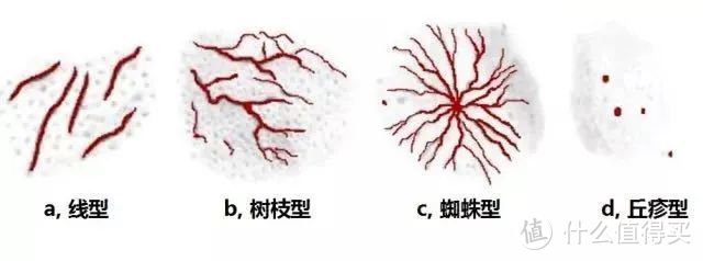 脸上有红血丝咋办？是不是没救了