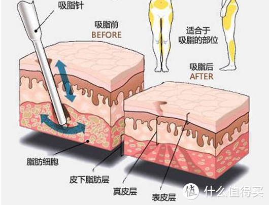 老生常谈的话题“减肥”，你成功的攻下它了吗.......