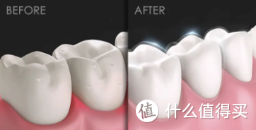 洗牙≠牙齿美白，你一定要知道它们的区别！